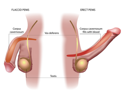 Gjennomskåret illustrasjon av penis i slapp og erigert tilstand, som viser hvordan corpus cavernosum fylles med blod ved ereksjon – relevant for å forstå hvordan penisringer virker.